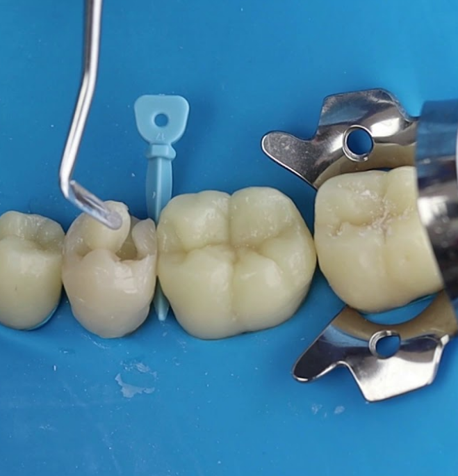 Biomimetic Dentistry