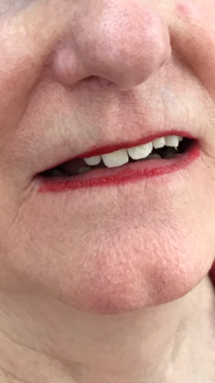 Before treatment 3