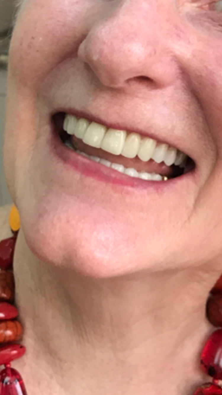 After treatment 3
