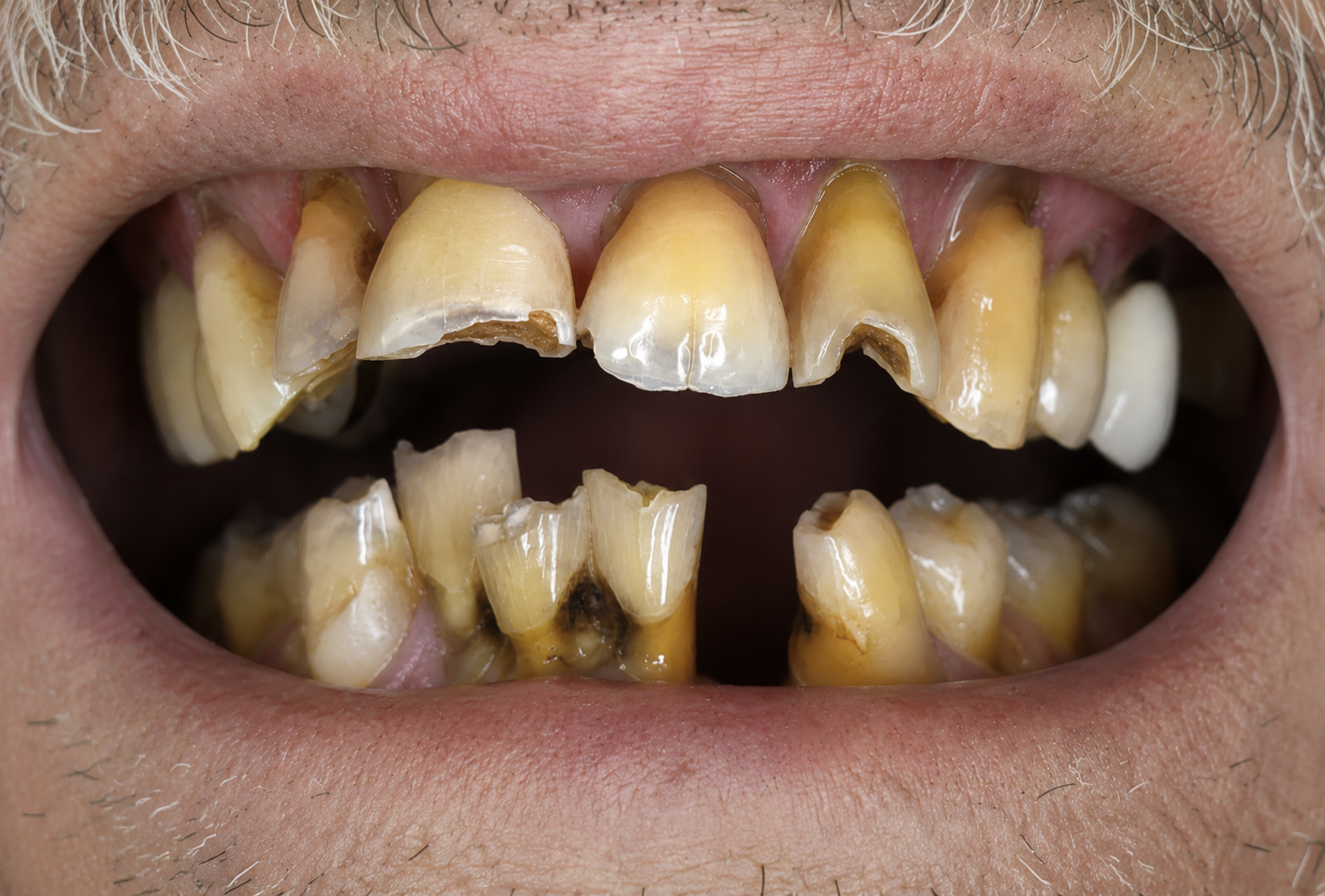Before treatment 4